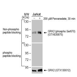 GRK2 (phospho Ser670) antibody [HL1035] (GTX635875)